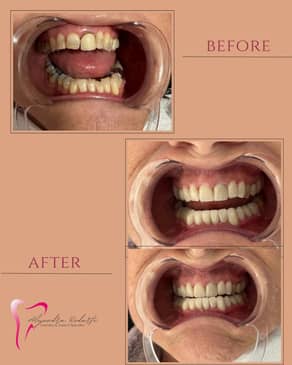 Slider image (8) Dr. Alejandra Rodarte Cosmetic & Implant Specialist